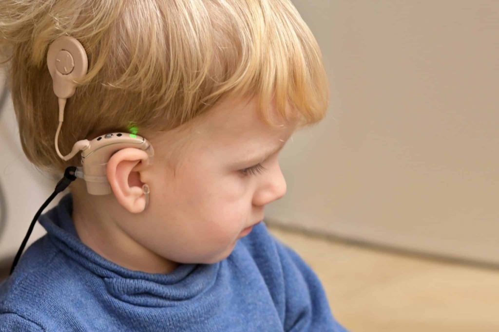 Cochlear Implants